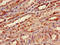 Kininogen 1 antibody, LS-C211442, Lifespan Biosciences, Immunohistochemistry paraffin image 