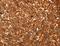 Aldolase, Fructose-Bisphosphate A antibody, LS-C400543, Lifespan Biosciences, Immunohistochemistry paraffin image 