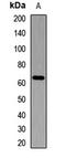 VICKZ family member 2 antibody, LS-C668311, Lifespan Biosciences, Western Blot image 