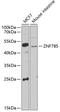 Zinc Finger Protein 785 antibody, 23-053, ProSci, Western Blot image 