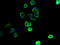 Solute Carrier Family 43 Member 3 antibody, A61010-100, Epigentek, Immunofluorescence image 