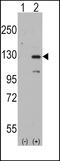 Dishevelled Associated Activator Of Morphogenesis 1 antibody, LS-B9032, Lifespan Biosciences, Western Blot image 