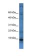 Transmembrane Protein 141 antibody, orb326367, Biorbyt, Western Blot image 