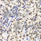 Centromere Protein C antibody, A6557, ABclonal Technology, Immunohistochemistry paraffin image 