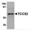 DDB1 And CUL4 Associated Factor 12 antibody, MBS150399, MyBioSource, Western Blot image 