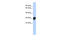 Carbonic Anhydrase 1 antibody, 27-165, ProSci, Enzyme Linked Immunosorbent Assay image 