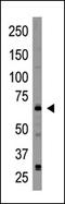 Cryptochrome Circadian Regulator 2 antibody, AP13098PU-N, Origene, Western Blot image 