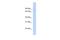 EF-Hand Domain Containing 1 antibody, A05955, Boster Biological Technology, Western Blot image 