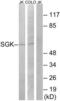 Serum/Glucocorticoid Regulated Kinase 1 antibody, LS-C199562, Lifespan Biosciences, Western Blot image 