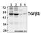 TGF beta antibody, GTX66628, GeneTex, Western Blot image 