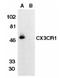 C-X3-C Motif Chemokine Receptor 1 antibody, AP05819PU-N, Origene, Western Blot image 