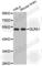 Glycine Receptor Alpha 1 antibody, A2958, ABclonal Technology, Western Blot image 