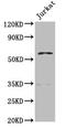 Propionyl-CoA Carboxylase Subunit Beta antibody, LS-C670992, Lifespan Biosciences, Western Blot image 
