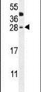 C-Type Lectin Domain Family 2 Member A antibody, PA5-24536, Invitrogen Antibodies, Western Blot image 