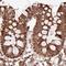 ATP Synthase F1 Subunit Alpha antibody, NBP2-38470, Novus Biologicals, Immunohistochemistry paraffin image 