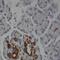 Secretory Carrier Membrane Protein 2 antibody, FNab07621, FineTest, Immunohistochemistry frozen image 
