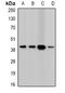 hA6RP antibody, abx141808, Abbexa, Western Blot image 
