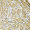 DNA Polymerase Gamma 2, Accessory Subunit antibody, LS-C334882, Lifespan Biosciences, Immunohistochemistry paraffin image 
