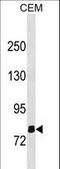 Olfactomedin Like 2B antibody, LS-C158007, Lifespan Biosciences, Western Blot image 