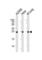 Rho GDP Dissociation Inhibitor Alpha antibody, abx031777, Abbexa, Western Blot image 