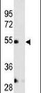 Matrix Metallopeptidase 12 antibody, PA5-13181, Invitrogen Antibodies, Western Blot image 