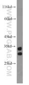 5'-Nucleotidase, Cytosolic IIIB antibody, 16292-1-AP, Proteintech Group, Western Blot image 