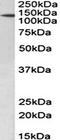 Patched 1 antibody, orb107648, Biorbyt, Western Blot image 