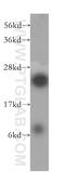 Ribosomal Protein L10a antibody, 16681-1-AP, Proteintech Group, Western Blot image 