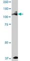 Alpha-protein kinase 1 antibody, H00080216-B01P, Novus Biologicals, Western Blot image 