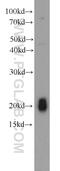 NPC Intracellular Cholesterol Transporter 2 antibody, 19888-1-AP, Proteintech Group, Western Blot image 