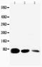 Epidermal Growth Factor antibody, PA5-79186, Invitrogen Antibodies, Western Blot image 