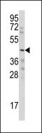 Cellular Communication Network Factor 6 antibody, 62-201, ProSci, Western Blot image 