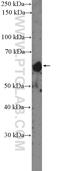 Serine Peptidase Inhibitor, Kunitz Type 1 antibody, 15036-1-AP, Proteintech Group, Western Blot image 