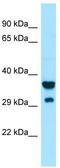 Signal Regulatory Protein Gamma antibody, TA338033, Origene, Western Blot image 