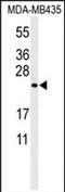 Zinc Finger CCHC-Type Containing 24 antibody, PA5-72389, Invitrogen Antibodies, Western Blot image 