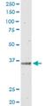 Interleukin 12B antibody, H00003593-M01, Novus Biologicals, Western Blot image 