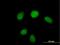 HUS1 Checkpoint Clamp Component antibody, H00003364-B01P, Novus Biologicals, Immunocytochemistry image 