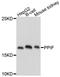 Peptidylprolyl Isomerase F antibody, A3208, ABclonal Technology, Western Blot image 