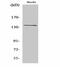 Adhesion G Protein-Coupled Receptor G6 antibody, A32344-1, Boster Biological Technology, Western Blot image 