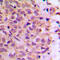 Coatomer Protein Complex Subunit Zeta 1 antibody, GTX56142, GeneTex, Immunohistochemistry paraffin image 