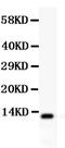 Trefoil factor 1 antibody, PB9522, Boster Biological Technology, Western Blot image 