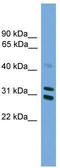 Proteasome Activator Subunit 2 antibody, TA342179, Origene, Western Blot image 