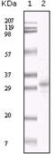 KSHV ORF26 antibody, abx011058, Abbexa, Enzyme Linked Immunosorbent Assay image 