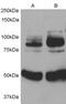 Adaptor Protein, Phosphotyrosine Interacting With PH Domain And Leucine Zipper 1 antibody, GTX89127, GeneTex, Western Blot image 