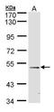 Forkhead box protein D1 antibody, GTX100271, GeneTex, Western Blot image 