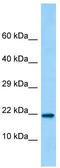 Uncharacterized protein C15orf53 antibody, TA331487, Origene, Western Blot image 