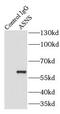 Asparagine Synthetase (Glutamine-Hydrolyzing) antibody, FNab00644, FineTest, Immunoprecipitation image 