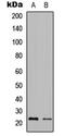 Granzyme H antibody, abx121409, Abbexa, Western Blot image 