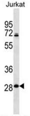 60S ribosomal protein L11 antibody, AP53706PU-N, Origene, Western Blot image 