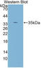 Protein Kinase C Gamma antibody, LS-C314179, Lifespan Biosciences, Western Blot image 